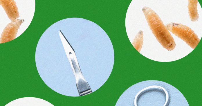 Got maggots? These doctors are bringing the bugs into their practice on purpose