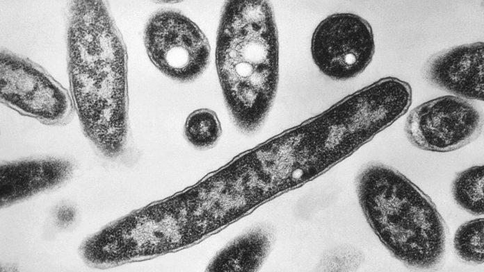 New cases slow in NYC Legionnaires' disease outbreak; Met museum among buildings with positive tests