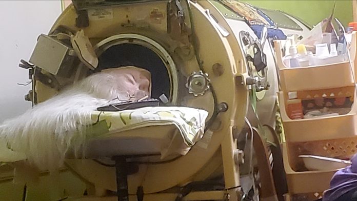 Martha Lillard, last US polio patient using iron lung, dies at 78 in Oklahoma