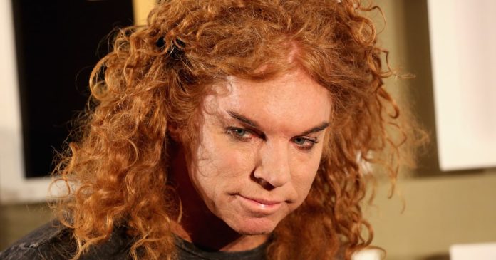Comedian Carrot Top hospitalized and recovering, representative says
